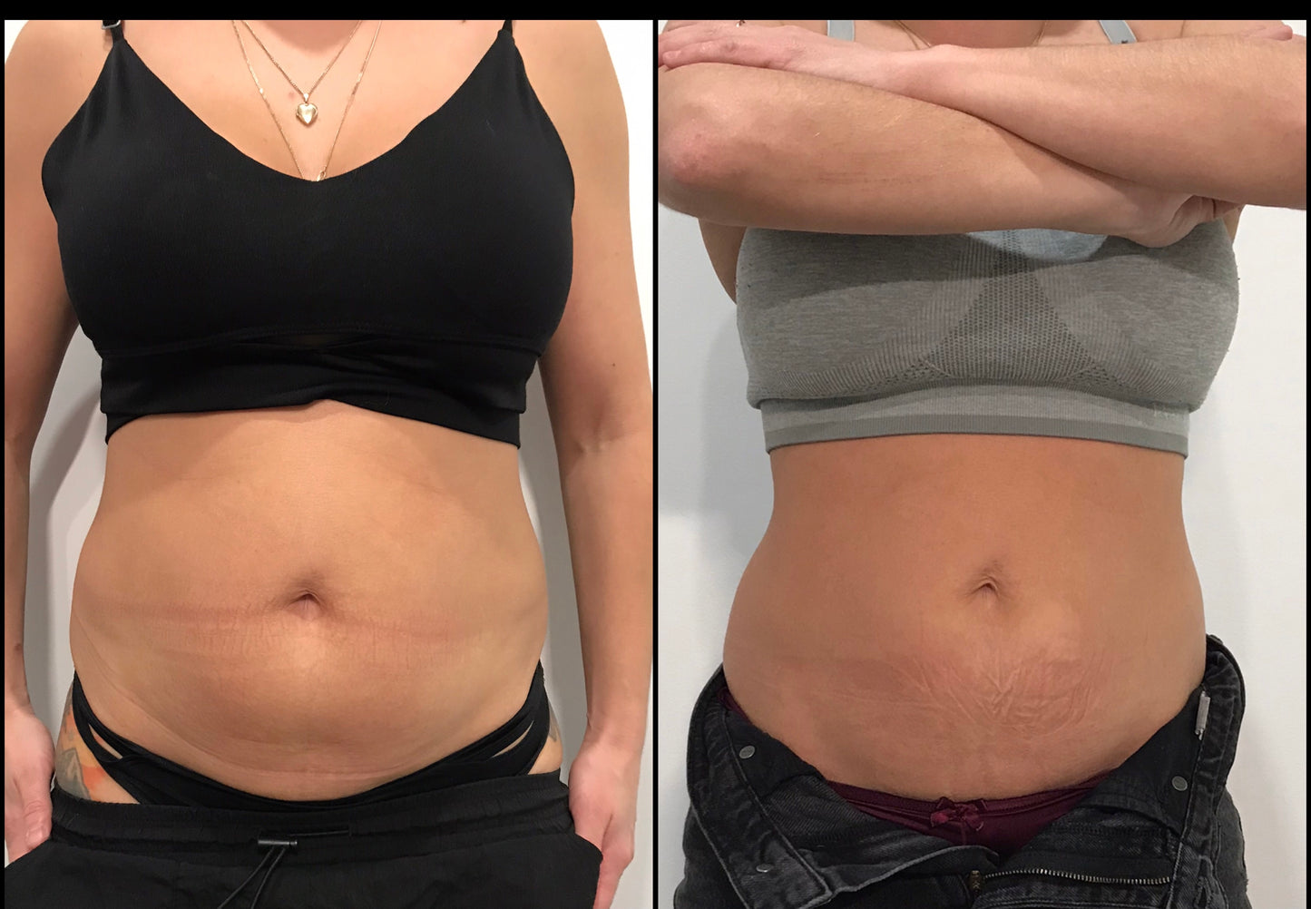 đ„ Cure Hot & Tight EXPRESS â Fonte Adipeuse & Skin Tightening Corps