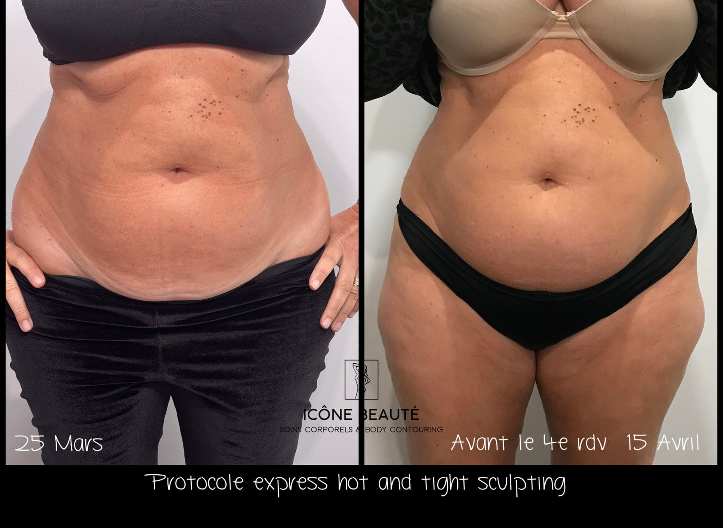 đ„ Cure Hot & Tight EXPRESS â Fonte Adipeuse & Skin Tightening Corps