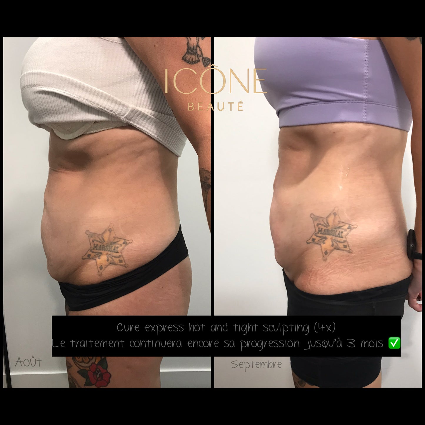 đ„ Cure Hot & Tight EXPRESS â Fonte Adipeuse & Skin Tightening Corps