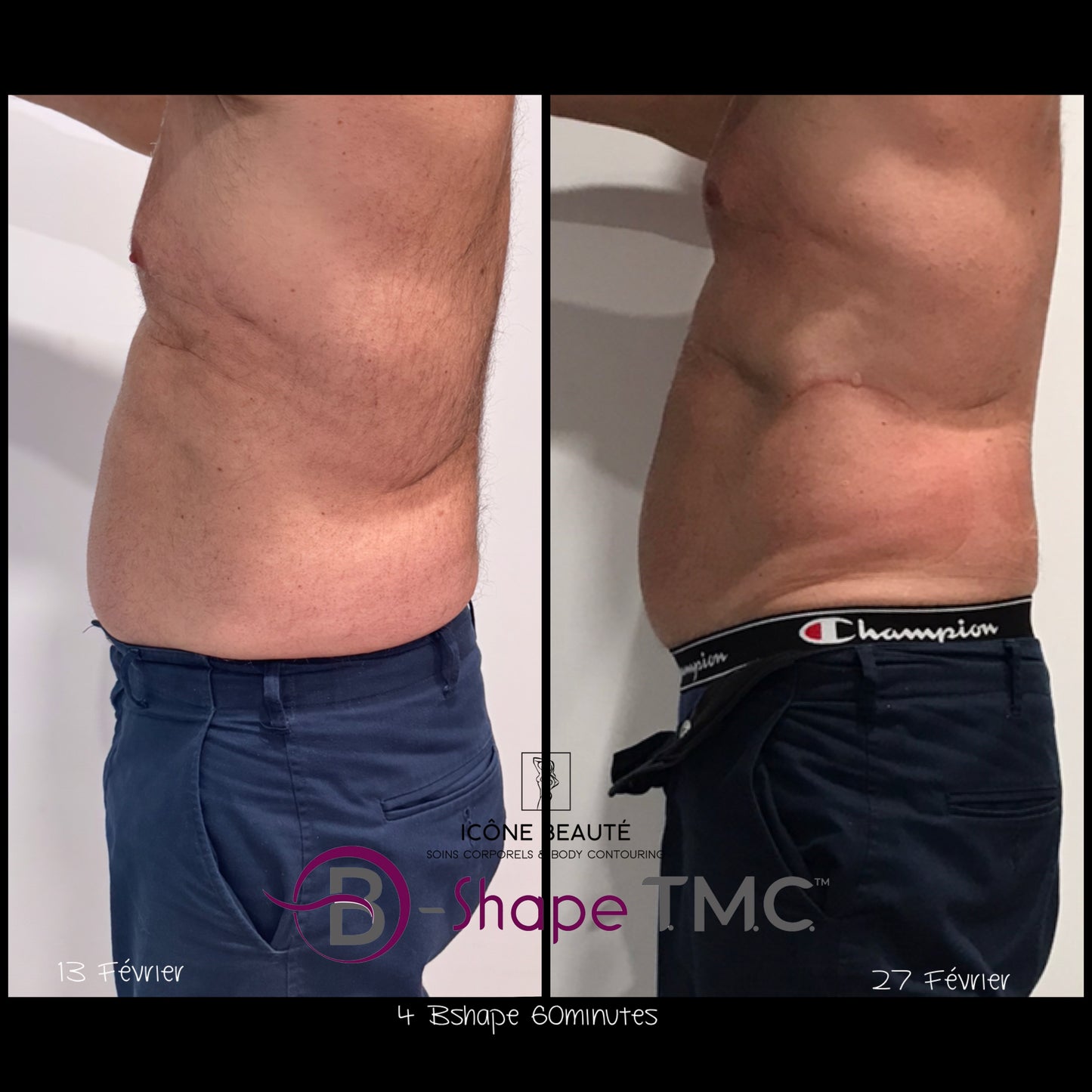đȘ BSHAPE â Musculation AvancĂ©e (T.M.C.)