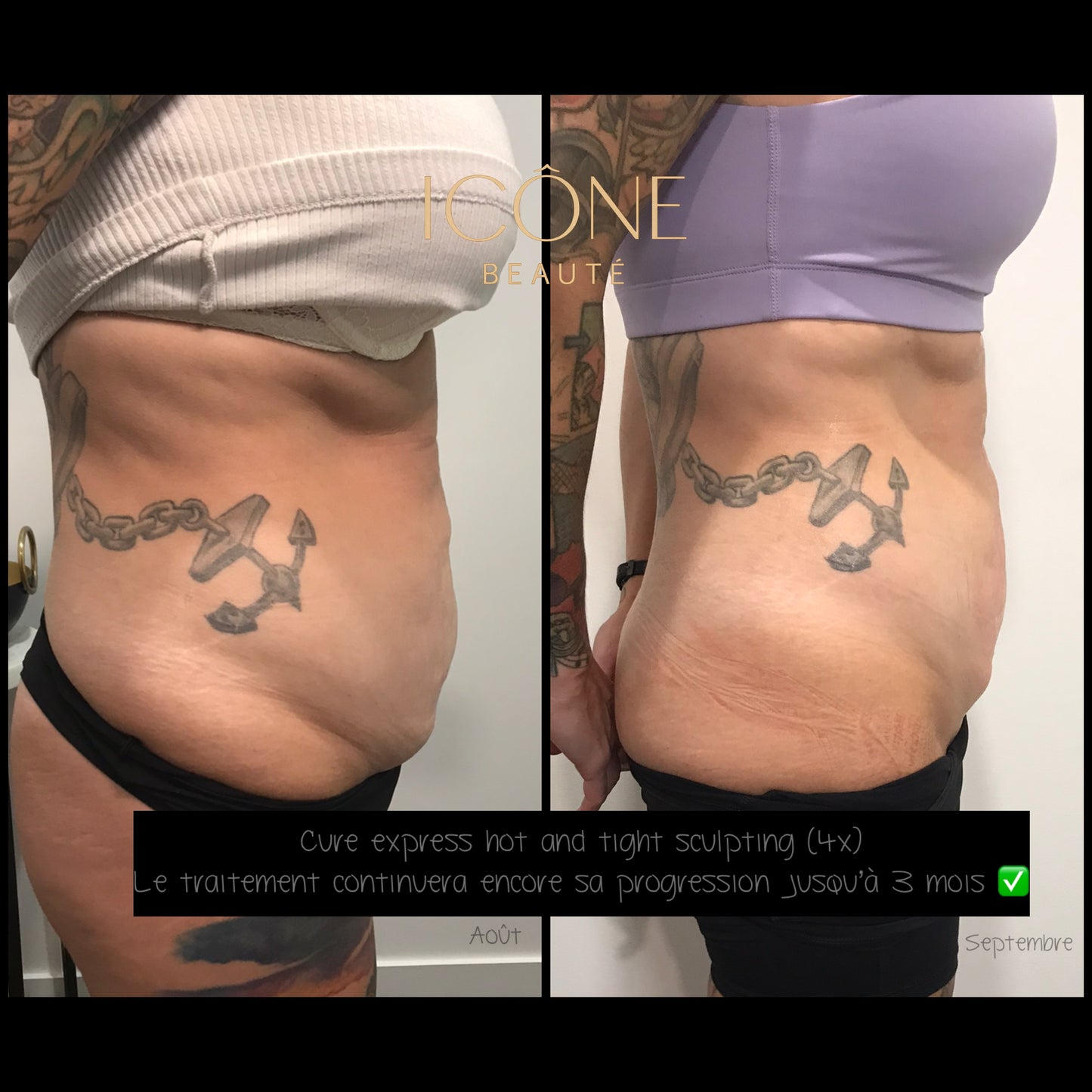 đ„ Cure Hot & Tight EXPRESS â Fonte Adipeuse & Skin Tightening Corps