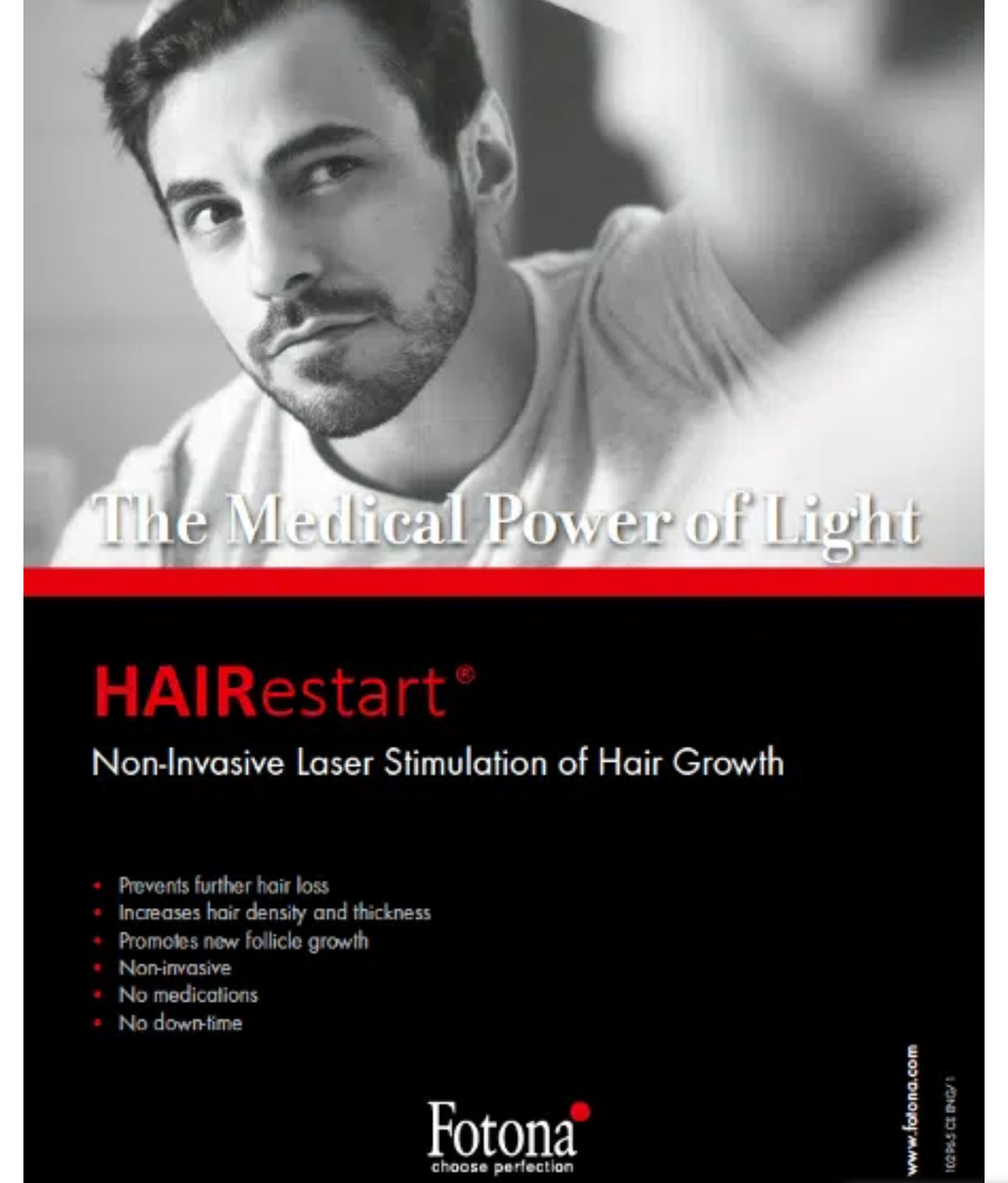 đč DENSIFICATION CAPILLAIRE - Laser Fotona - HairRestartÂź