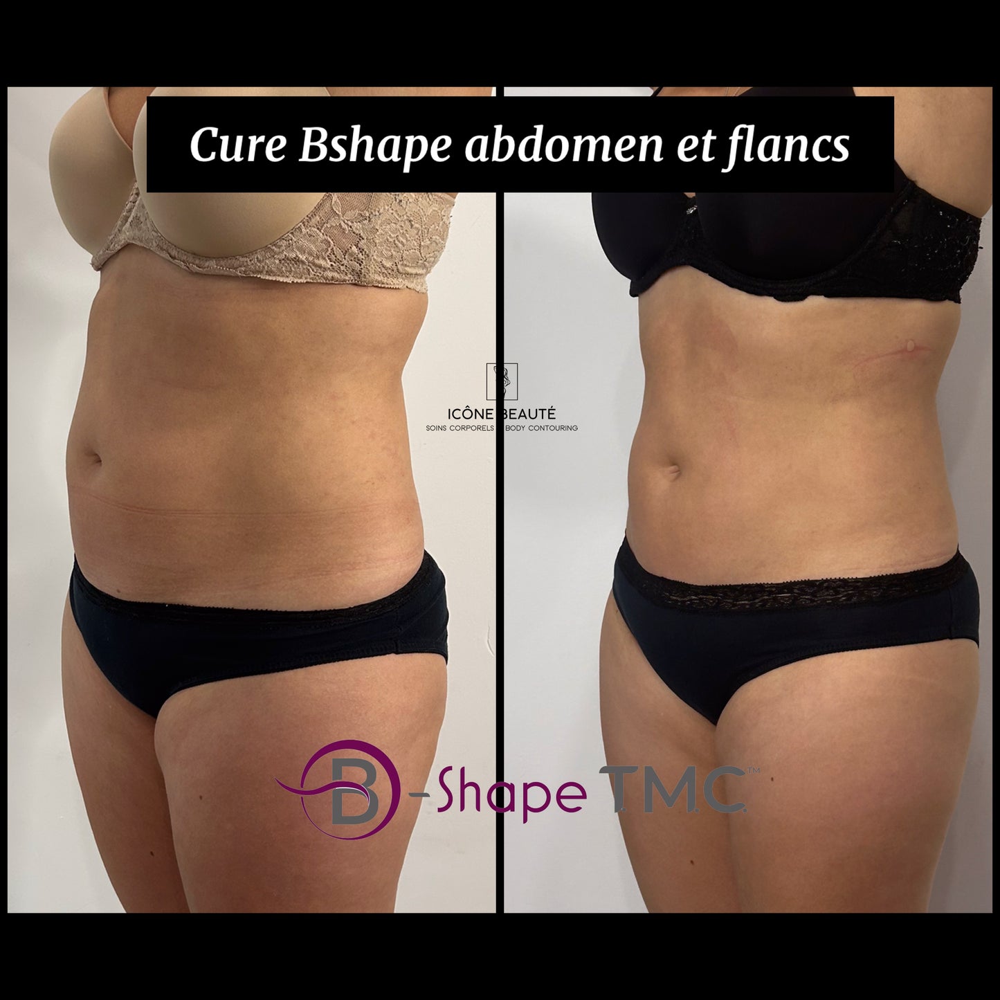 💪 BSHAPE – Musculation Avancée (T.M.C.)