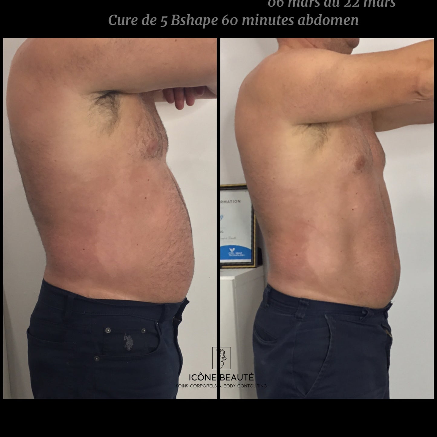 💪 BSHAPE – Musculation Avancée (T.M.C.)
