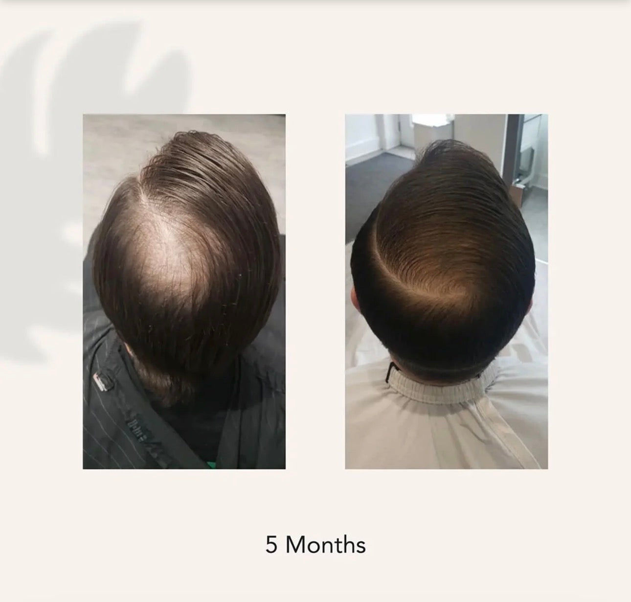 ACT/IV – Shampooing Épaississant pour Homme | Thicker • Fuller Hair