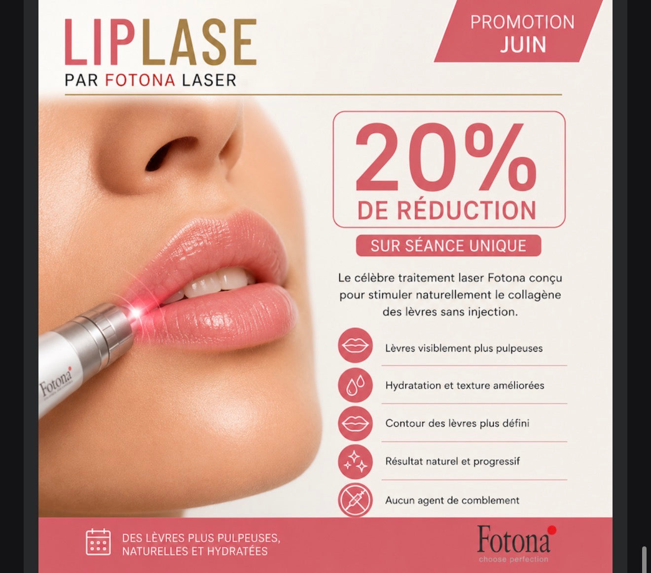 💋 LipLase® – Lèvres pulpeuses au naturel